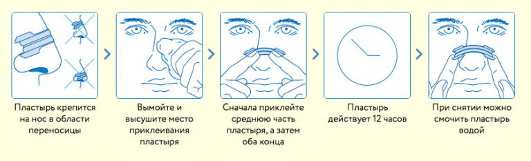 Тейпирование носа схемы