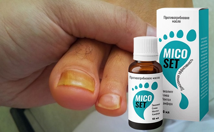MICOSET от грибка ногтей: способствует быстрому оздоровлению кожных покровов и тканей!