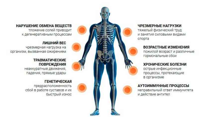 Ломит кости и суставы причины. Перечень болезней суставов. Причины заболевания суставов. Симптомы поражения суставов. Симптоматика болезни суставов.