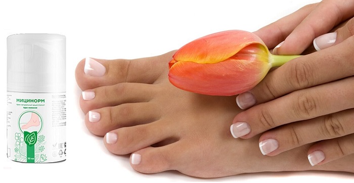 Мицинорм от грибка на ногах и ногтях: здоровые ногти и чистая кожа уже через 2 недели применения!