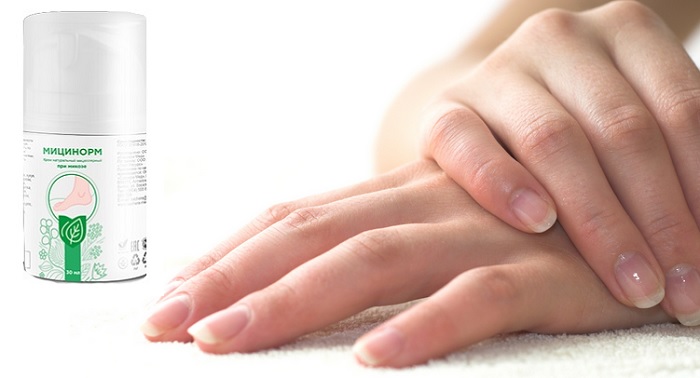 Мицинорм от грибка на ногах и ногтях: здоровые ногти и чистая кожа уже через 2 недели применения!